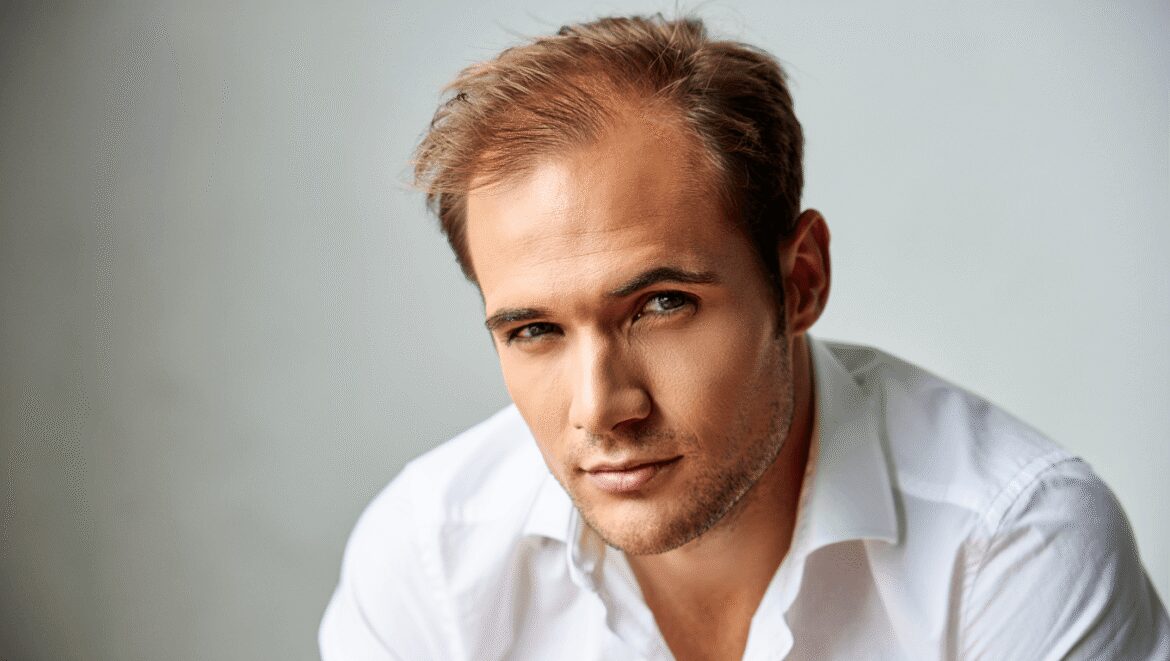 Cheveux fins homme : les meilleures coupes et coiffures pour gagner du volume