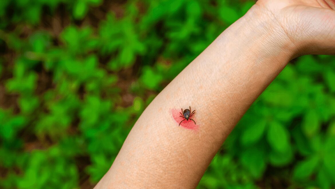 Tiques : l’anamoplasmose, pire que Lyme ?