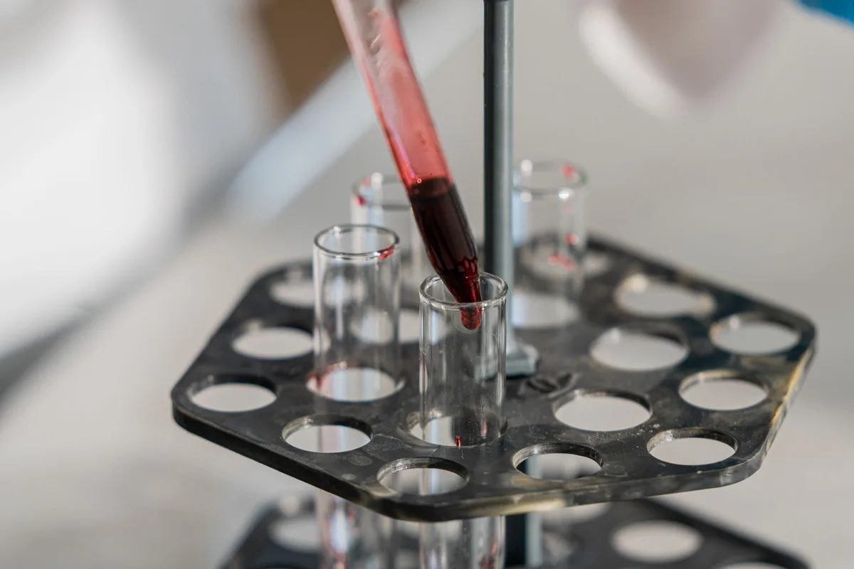 Prélèvement sanguin en laboratoire pour un test génétique