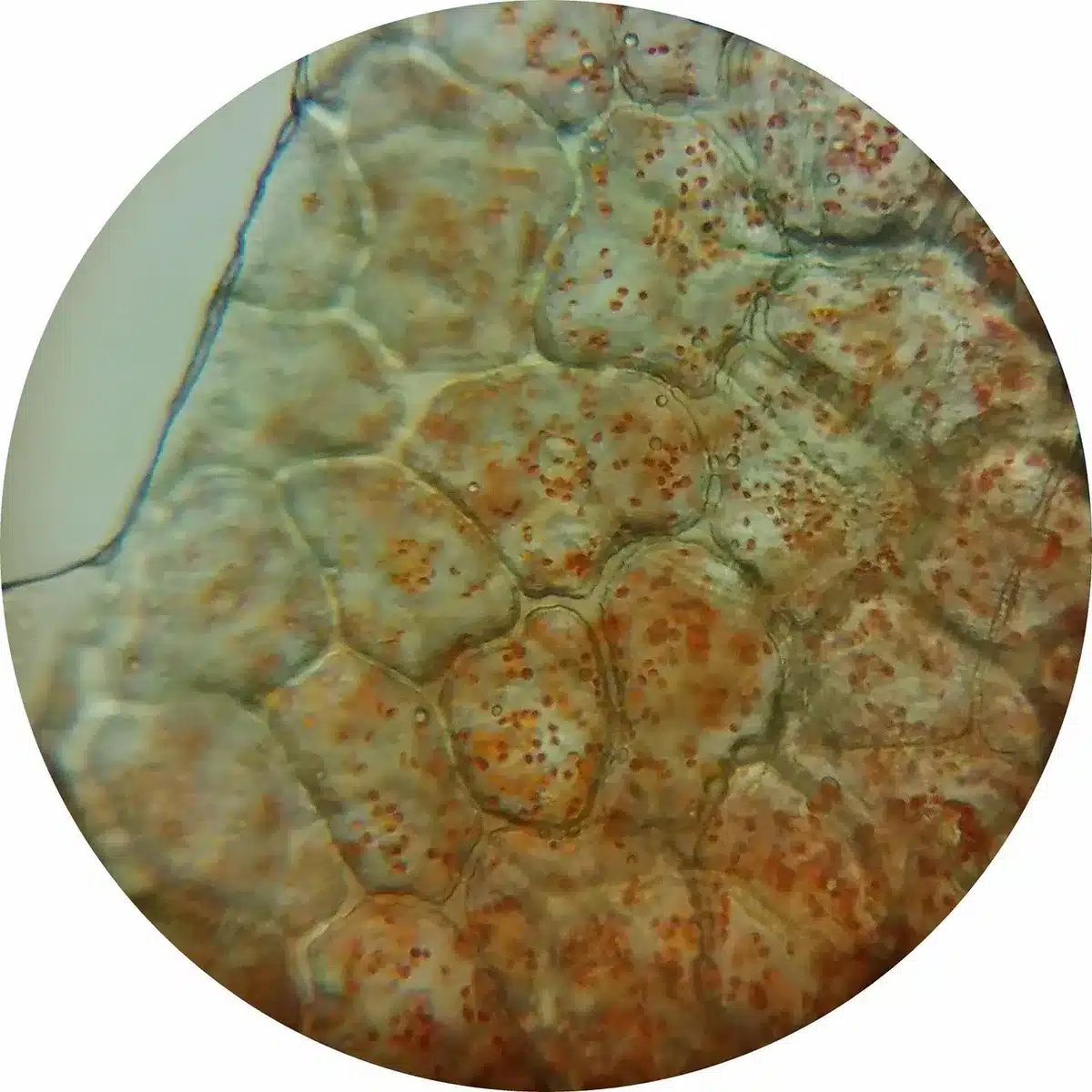 Illustration microscopique d'inflammation et cellules endommagées