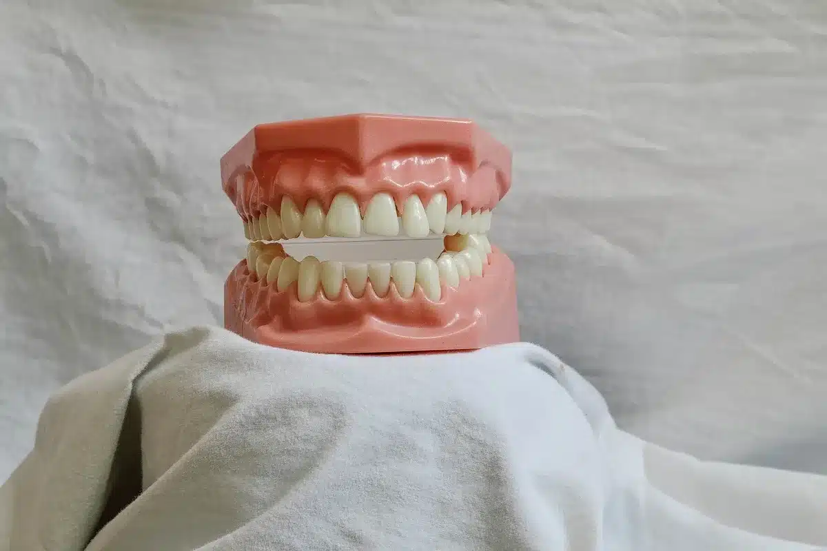 Illustration anatomique de la bouche montrant la muqueuse, les gencives et les dents